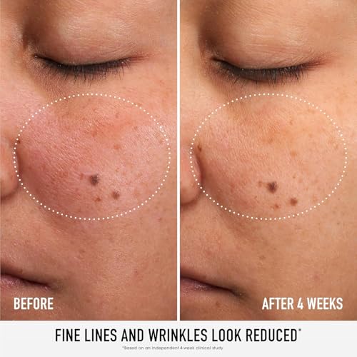 bareMinerals Skin Rescue Face Serum, Improve Skin Condition in 1 Week, Tested on Sensitive Skin, Vegan, 1 Fl Oz