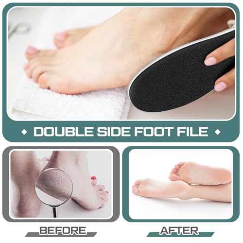 Lothee 30 Pack Foot File Foot Callus Remover Double Sided Professional Sandpaper Pedicure Tool Feet Scrubber Sander Feet Rasp for Dead Skin Cracked Heel Women Manicure Beauty Spa, 100/180 Grit, White