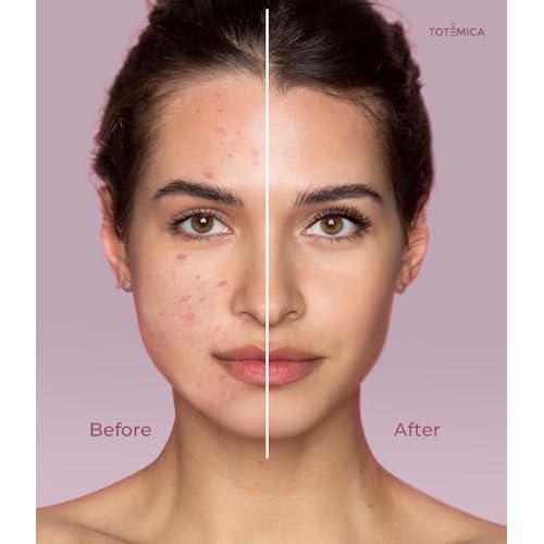 TOT?MICA Make up Remover, Cleansing Oil with Rice Bran & Jojoba, Waterproof Mascara Remover, Gentle & Hydrating Facial Cleanser for All Skin Types, Desmaquillantes para la cara - 150ml