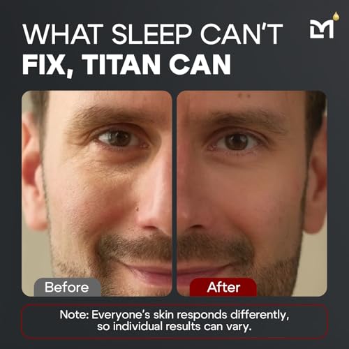 Titan Mens Eye Cream Anti Aging for Dark Circles Under Eye Treatment ? Eye Bags Treatment for Men ? Under Eye Bag Remover ? Crows Feet Eye Wrinkle Cream ? Peptides & HA ? All Skin ? Unscented