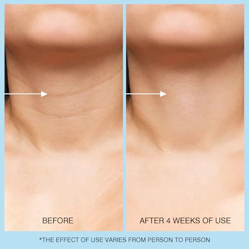 Retinol Neck Cream - Hyaluronic Acid & Caffeine Enriched Neck Firming Cream | Anti-Aging 3-in-1 Moisturizing Cream to Minimize Fine Lines, Dullness & Sagging Skin for Neck, Chest & Face (50ml/1.7oz)