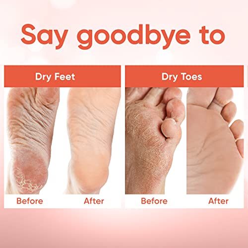 C?LOR Foot Peeling Mask for Dry Cracked Feet | Foot Mask to Exfoliate Rough, Cracked, Dry Feet, Calluses for Soft Baby Feet Results | Made with Aloe Vera Extract for Women & Men (5 Pairs) | Peach