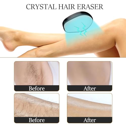 Crystal Hair Eraser, Painless Hair Removal Tool, Reusable Hair Remover for All Body Parts (Black)