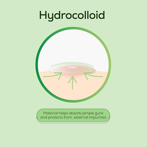 HANHOO Soothing Blemish Patch with Aloe, Madecassic Acid, and Tea Tree Extract | Hydrocolloid Spot Treatment | Calms Pre-stage, Irritated, and Popped Blemishes 216 count
