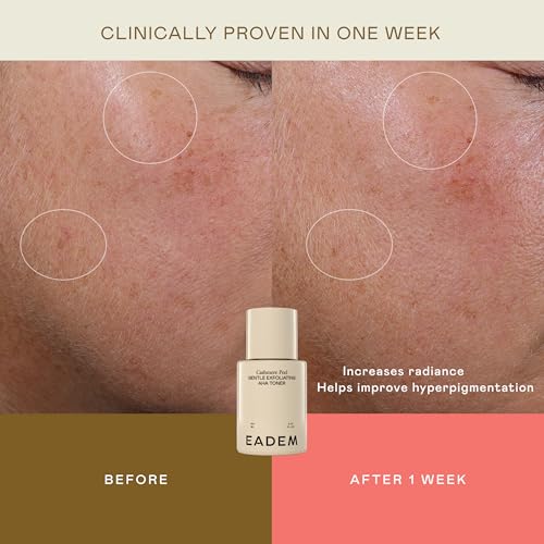 EADEM Gentle Exfoliating AHA & PHA Toner, Milky Rice Toner Exfoliant with Lactic, Azelaic, & Tranexamic Acid, Rice Water AHA Exfoliator & Pore Minimizer for Face and Body, 5.0 oz, Cashmere Peel