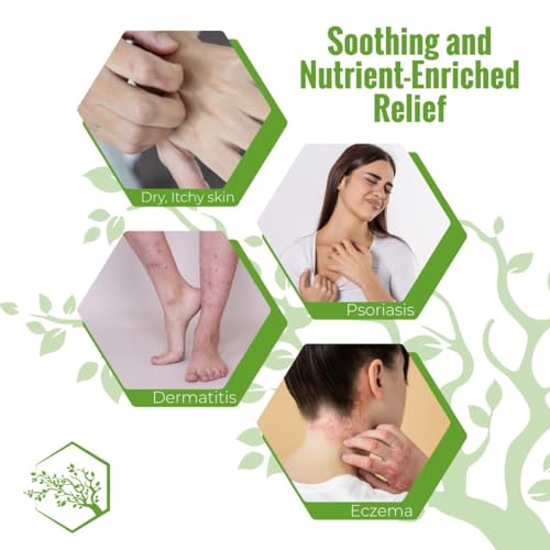 Wild Naturals Moisturizing Eczema Body Wash ? Gentle Psoriasis Body Wash for Itchy, Dry Skin Relief ? Eczema Soap for Redness and Flareups ? Hydrating Cleanser for Women and Men