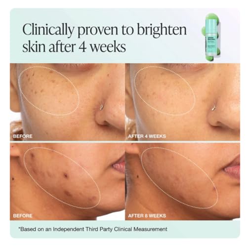 INNBEAUTY PROJECT Green Machine Vitamin C Dark Spot & Hyperpigmentation Serum, REFILL, 1 FL OZ (30ml)