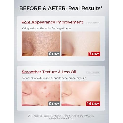 2% Salicylic Acid Serum: Pore Minimizer & Acne Treatment for Face with AHA PHA Tranexamic Acid Niacinamide & Tembusu Extract | Exfoliant for Acne & Blemish Skin | Oil Control | 1 FL OZ