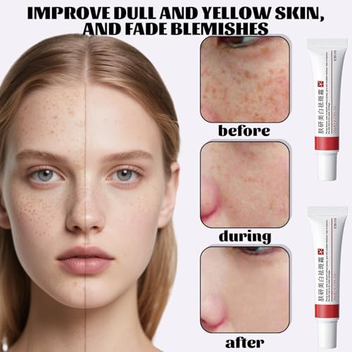 Crema para Manchas Oscuras en la Cara, Cremas para Quitar Manchas de la Cara, Cremas Hidratante paras Melasma en las Cara, Crema Blanqueadora paras las Manchas de la Cara for Mujer & Hombre (3)