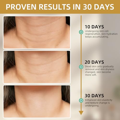 Anti Aging Firming Neck Cream, 5-IN-1 Face Tighten and Lift Neck Cream, Anti Wrinkle Neck Retinol & Collagen Cream, Chest Neck & Face Lifting|Repairing|Moisturzing Skin Care for Men & Women - New