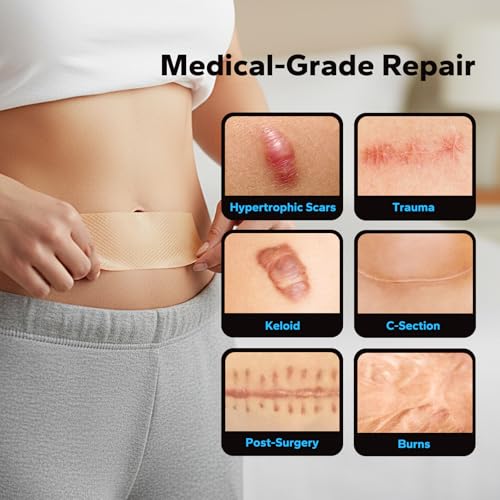 Silicone Scar Sheets (1.6" x 60" Roll - 1.5M), Silicone Scar Tape, Silicone Scar Sheets for Surgical Scars, Keloids & C-Section Scars, Reusable & Washable Scar Patches for Face & Body