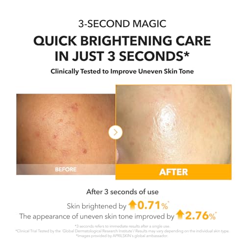 APRILSKIN A.C.E Serum£üVita Kojic Serum for Brightening & Glow£ü3-Second Brightening£üKojic Acid & Vitamin C for Uneven Skin Tone£üKorean Skin Care£ü3.88 oz.