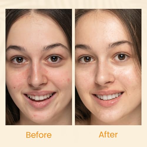 Honeyskin Gel Moisturizer for face ? Lightweight Water Gel Infused with Coconut water with Niacinamide & Peptides for Deep Hydration ? Hypoallergenic Face Moisturizer for Women 2oz