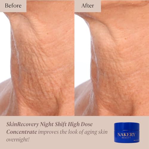 Nakery Night Shift Overnight Face Cream, Retinol Sleep Repair Cream with Methylene Blue, NAD+, and Melatonin, Anti-Aging Night Moisturizer for Fine Lines, Collagen Boost, and Cellular Renewal