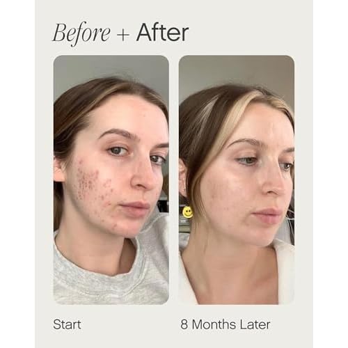 Topicals Faded Brightening and Clearing Serum | Reduces Discoloration, Post-Blemish Marks, Scars and Spots | Contains Kojic Acid and Niacinamide | Dermatologist-tested, Vegan, Cruelty-Free (0.5 Fl Oz)