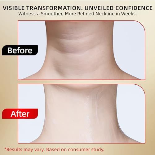Neck Firming Cream - Retinol, Collagen & Hyaluronic Acid Neck Cream, Anti-Aging, Firming, for Neck & D?collet? - 1.76 fl.oz