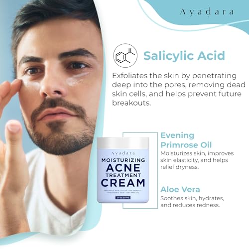 Moisturizing Acne Cream, Salicylic Acid Face Moisturizer for Oily & Acne-Prone Skin, Helps with Pimples, Blackheads, Whiteheads, Hormonal & Cystic Acne, for Men and Women, 90-Day Supply by Ayadara