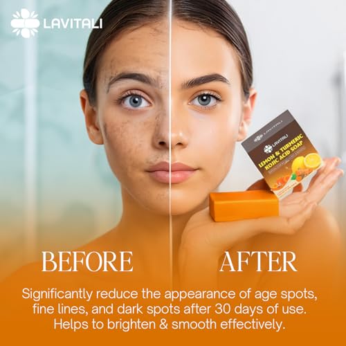 LaVitali, Premium 6 Bars Kojic Acid Soat with Lemon Turmeric, Natural soap, Handmade, Sugar/Caffeine/Gluten Free, 100% Natural & Pure, Great For All Skin Types Body Care Body Wash