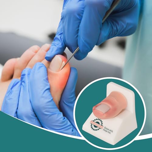 Ingrown Toenail Trainer Kit with Base,Ingrown Toenail Simulator for Medical Education, Wound Care Training Model