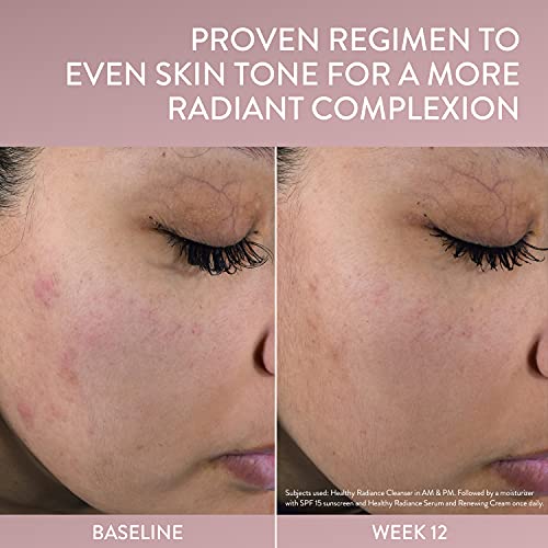 Cetaphil Face Serum, Healthy Radiance Antioxidant-C Serum, Visibly Reduces Look of Dark Spots and Hyperpigmentation, Designed for Sensitive Skin, Hypoallergenic, Fragrance Free, 1 oz