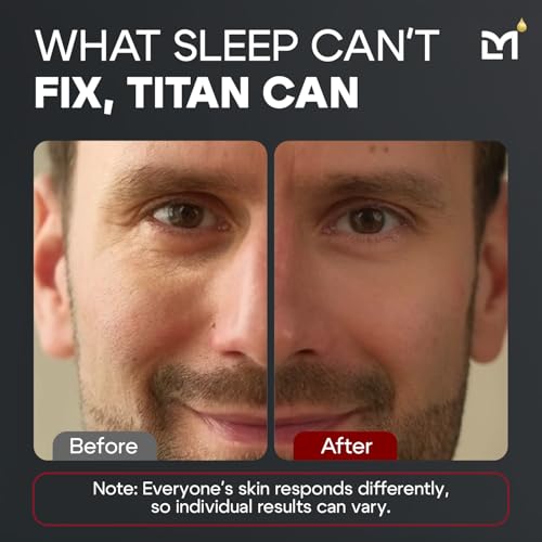 Titan Peptide Cooling Eye Serum ? Mens Eye Cream ? Anti-Aging Bags & Dark Circle ? Appearance of Under Eye Bags Treatment for Men, Puffy Eyes Treatment Men ?Peptides, HA, DMAE, MSM ?Unscented