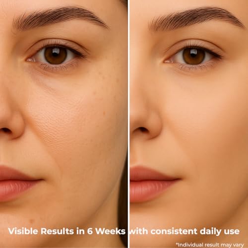 Hydrating Hyaluronic Acid Face Toner for Sensitive Skin ? Pore-Minimizing, Anti-Aging & Radiance-Boosting with Aloe Vera, Oat & Birch Leaf ? Alcohol-Free & Dermatologically Tested