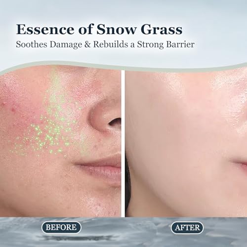 CaviarEssence Face Mask - Soothe & Replenish with Centella, Chamomile & Hyaluronic Acid. Calms Redness & Strengthens Skin Barrier for All Types (3.4 oz)
