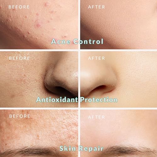 PureNaturis Organic Dead Sea Mud Mask for Face & Body, Premium Spa Quality Pore Minimizer for Acne, Blackheads, Oily Skin -Skin Tightening Formula for Women & Men, Achieves Healthier Complexion 8.8 oz
