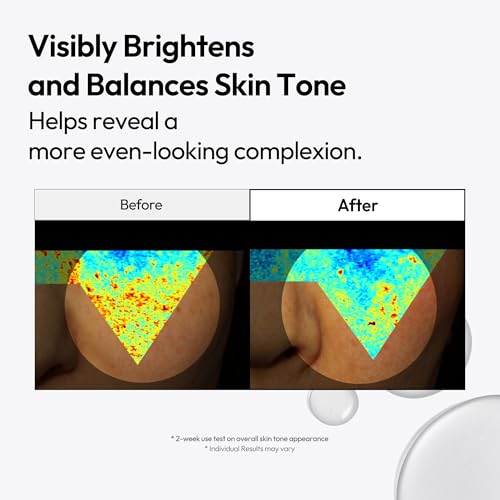 LAYERLAB Niacinamide 7% & Tranexamic Acid 3% Dark Spot Appearance Serum | 13% Radiance Complex Visibly Evens Skin Tone Look | Hydrating K-Beauty Skincare 0.94 fl.oz