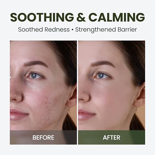 HyCicaMue Soothing Cream | Water Based Gel Moisturizer for Skin Recovery | Cica, Panthenol, Ceramide, Hyaluronic Acid | Boosts Hydration & Calms for Refreshing Skin Balance | Korean Skin Care