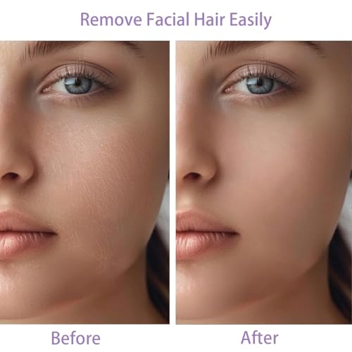 Women Facial Hair Removal Device Battery Operated with 2 Replacement Heads, Painless Womens Face Shaver for Chin Upper Lips Peach Fuzz