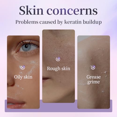 Face Exfoliator, Gentle Exfoliating Gel & Gommage for Face and Body, Removes Dead Skin Cells, Deep Cleansing & Hydrating for Dry & Sensitive Skin, Non-Abrasive Formula, 2.03 Fl Oz
