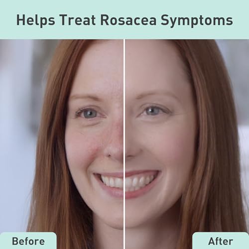Procure Rosacare CC Hydrogel 2 fl oz