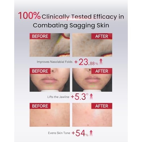 Harken Dermatology - Ultimate Shield All-Day Protection Mineral Sunscreen | SPF 50 | 80 Minute Water Resistant | Face + Body | Reef Safe | Botanical Antioxidant Complex | Travel Size