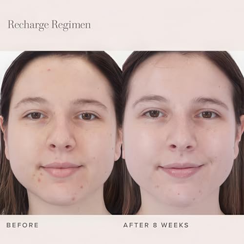 RODAN + FIELDS RECHARGE 3-in-1 Super Cleanser | 125 mL | Daily Exfoliating Gel Cream Face Wash with Australian Lime Pearl Extract & Electrolytes | Removes Makeup, Oil, & Dirt | Smoothing Skin Care