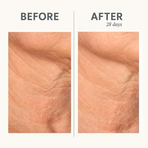 Serious Skincare Reverse Lift CORREC-CHIN IN-TENSE Firming Treatment Cream, for Tightening Double Chin, Neck, Jawline, Anti-Aging Moisturizer, Firming Skin Care 1.7 oz