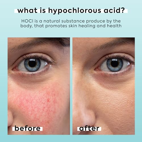 Hypochlorous Acid Spray for Face & Body - 3.4 fl oz 0.02% HOCL - Helps Reduce Redness and Breakouts - Travel Size Hypochlorous Spray - Multi-Purpose Topical Facial Skin Repair - pH-Balancing Toner