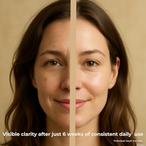 Youth Essence Brightening Face Serum - Even Skin Tone, Plumps & Hydrates with Kudzu, Centella Asiatica, Hyaluronic Acid ? Brightening Face Serum. Vegan & Dermatologically Tested