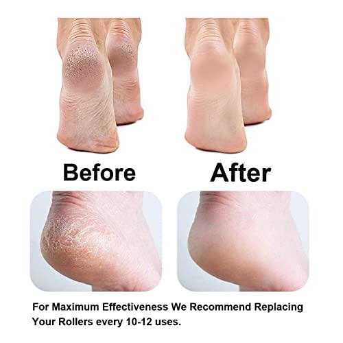 Replacement Roller Compatible with Dr. Scholl's Callus Remover Electronic Foot File-Extra Coarse (6 Pack)
