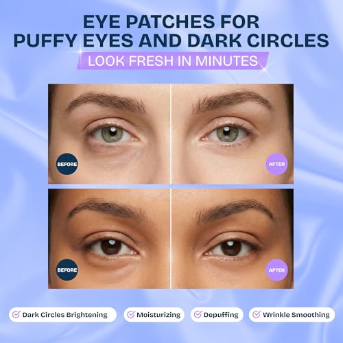 MAREE Under Eye Patches for Puffy Eyes and Dark Circles ? Under Eye Mask with Collagen & Hyaluronic Acid ? Undereye Mask Patches for Women ? Parches para Ojeras Puffiness & Under Eye Bags | 12 Pair