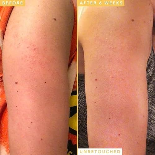 Farmacy Honeymoon Glow Body - AHA and BHA Body Serum with Hyaluronic Acid - Resurfacing Lactic Acid Body Lotion for Dry Skin