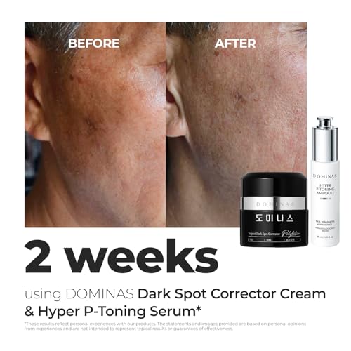 DOMINAS Dark Spot Corrector Cream - Visibly Reduce Age Spots, Sun Spots with TXA, Niacinamide and Bakuchiol, Brightening Daily Moisturizer for Uneven Tone and After Spot Care, Korean Skincare, 1.76 oz