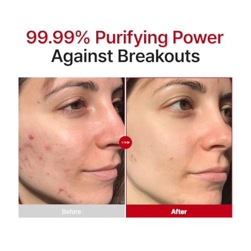 PURITO Hypochlorous Acid Facial Spray | Witch Hazel 5% + Forest Breeze | HOCl Facial Mist for Sensitive, Redness-Prone Skin | Refreshing Toner Mist | Korean Skincare, 100mL / 3.38 fl.oz