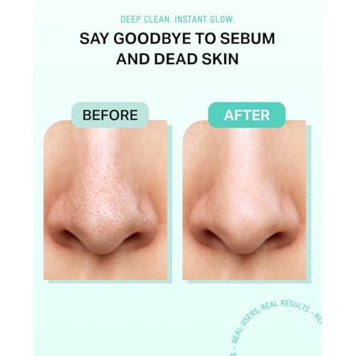 BRING GREEN Tea Tree Cica Sebum Cleaning Gel Set | Korean Blackhead Remover & Pore Minimizer with Pore Cleaner Tool | Sebum Softener for Face, Nose & Chin | Gentle Alternative to Pore Strips & Vacuums