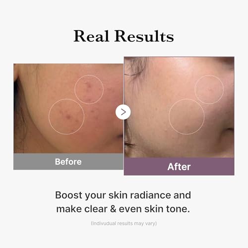 medicube All Over Glow Skin Duo: Deep Vitamin C Golden Capsule Face Moisturizer and Age-R Glutathione Glow Milky Toner