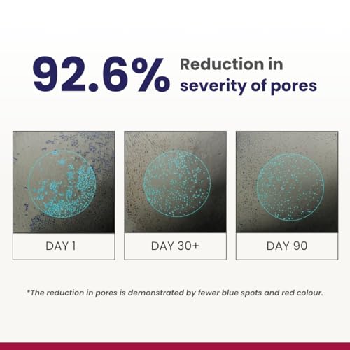 RE' EQUIL 0.3% Retinol Night Cream, Improves Skin Texture, Reduces Acne, Unisex, For All Skin Types, 30G
