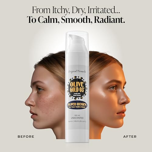 Olive Gold O3 Skin Care Lotion ? Ozonated Olive Oil Moisturizer for Face & Body, Natural Hydration & Anti-Aging Support (4oz)