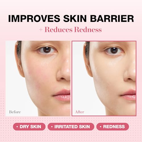 Physiogel Redness Reducing Cream ? Ceramide Moisturizer for Dry, Sensitive & Redness-Prone Skin, Repairs Skin Barrier, Dermatologist-Tested, Fragrance-Free, Korean Skincare, 1.69 fl oz