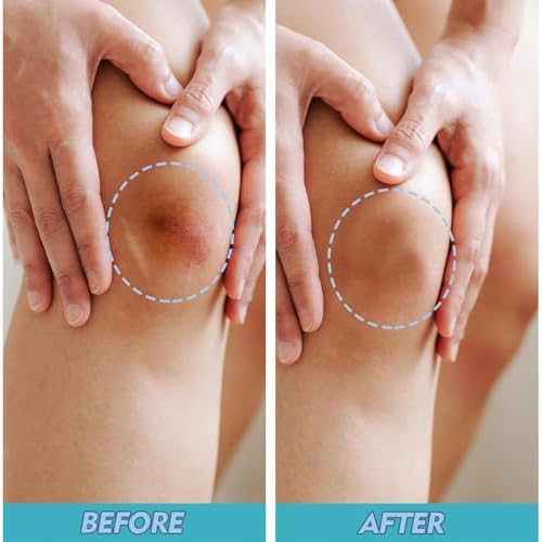 Rayyl Silicone Scar Sheets (1.6" x 60" Roll - 1.5M) - Advanced Silicone Scar Tape Roll Skin-Safe Flexible Strips for Smoother Looking Skin C-Section Recovery Everyday Scars Reusable Value Pack