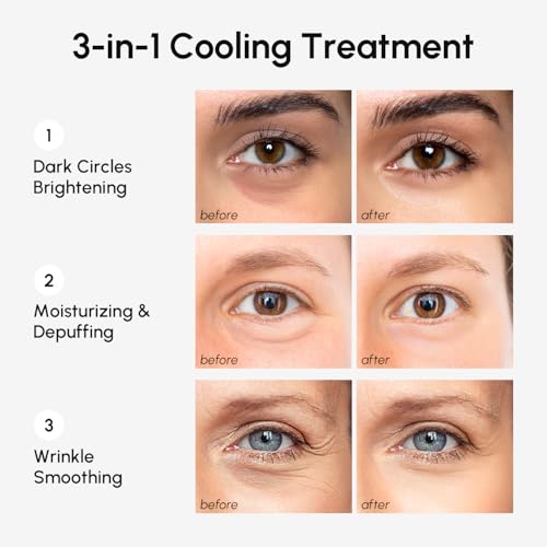 MAREE Hydrating Under Eye Patches for Puffy Eyes and Dark Circles ? Marine Collagen & Caffeine Eye Patches ? Brightening Eye Patche with Niacinamide ? Depuffing Eye Mask for Dark Circles and Puffiness